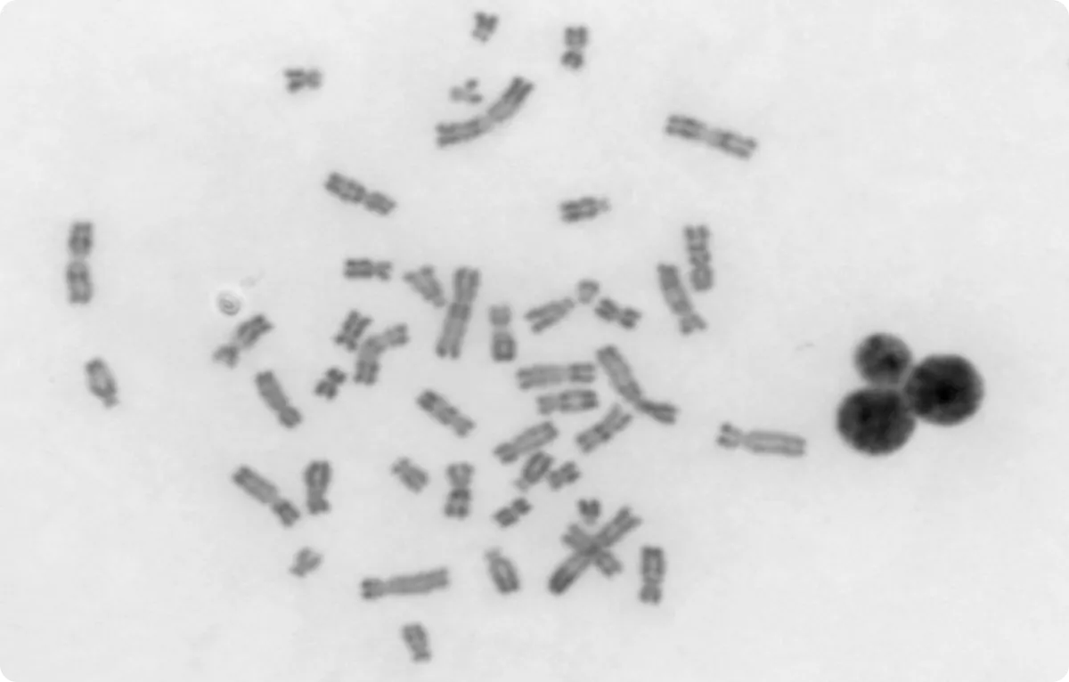 Caryotype constitutionnel post-natal