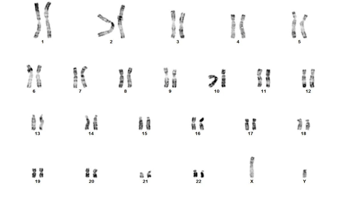 Caryotype onco-hématologique